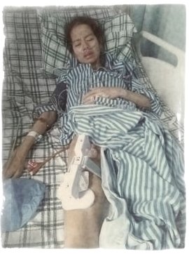 Tel after chemo